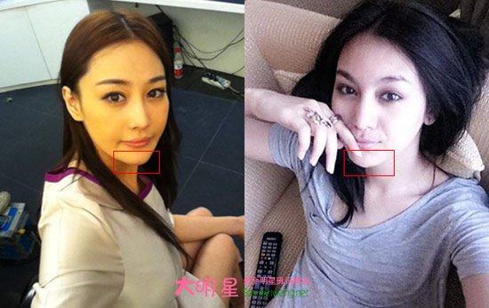 �����ȶ�