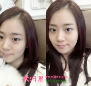 ��ʤ��,nichkhun