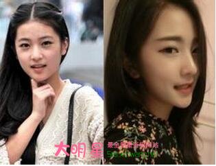 �ָ�,������